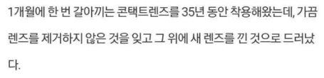 [유머] 67세 할머니 눈에서 나온 물건의 정체 -  와이드섬