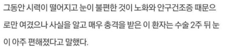 [유머] 67세 할머니 눈에서 나온 물건의 정체 -  와이드섬