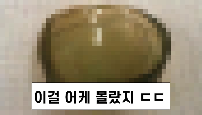 [유머] 67세 할머니 눈에서 나온 물건의 정체 -  와이드섬
