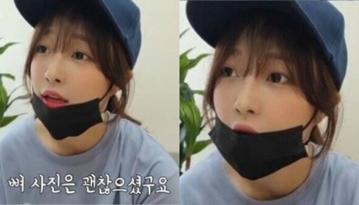 [유머] 예상과 달라서 놀라운 유튜버 쯔양 건강검진 결과 -  와이드섬