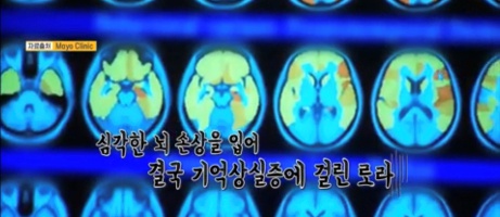 [유머] 사고로 기억 잃은 아내를 위해 남편이 한 행동 -  와이드섬